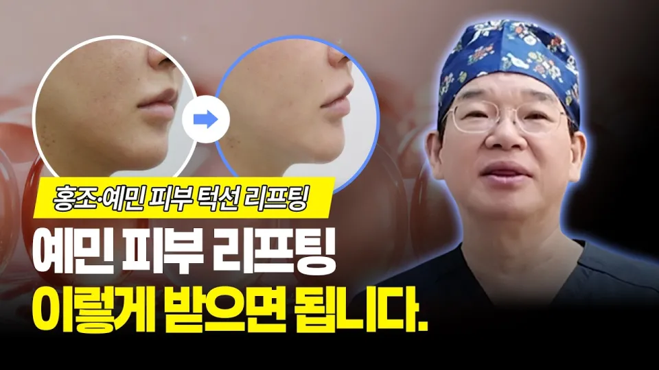 5 방법 예민피부 리프팅 시술 안전하게 받는 법
